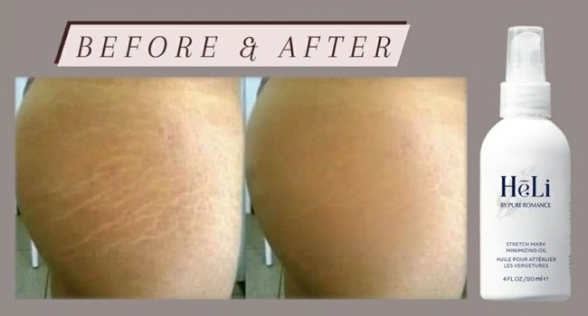 HēLi - Stretch Mark Minimizing Oil